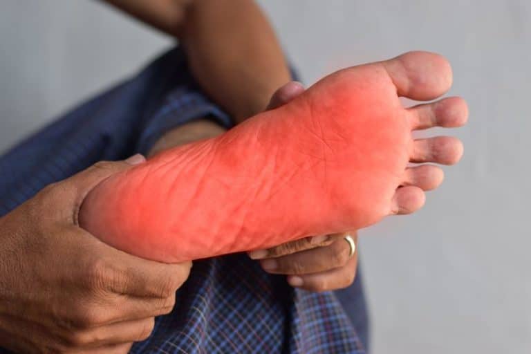 Diabetic Neuropathy. Peripheral Neuropathy.